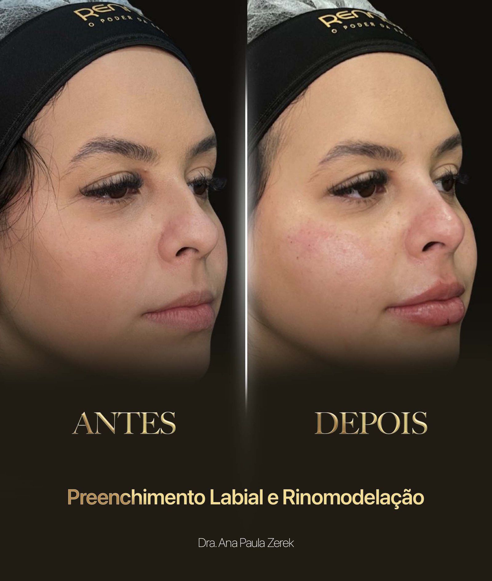 antesdps-novo-out-25-2