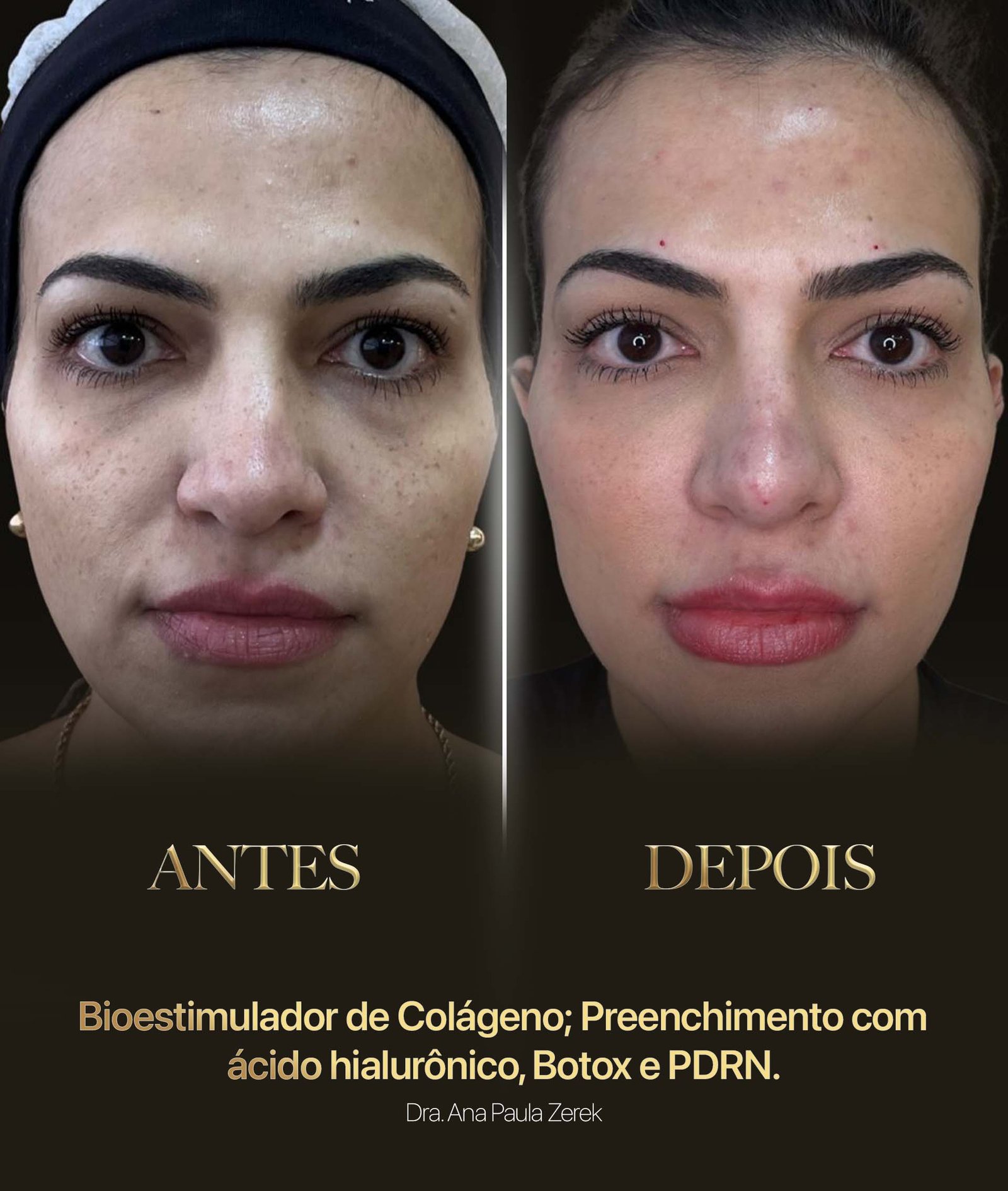 antesdps-novo-out-25